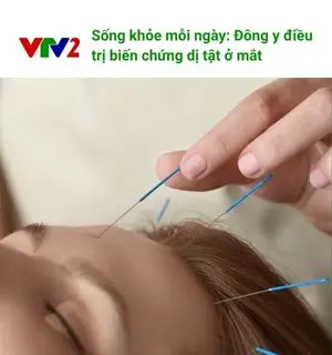 bao-chi-viet-ve-chung-toi