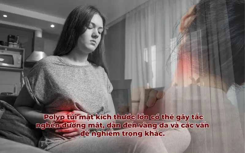 Polyp túi mật có thể làm tăng nguy cơ hình thành sỏi túi mật, gây đau đớn và viêm nhiễm.