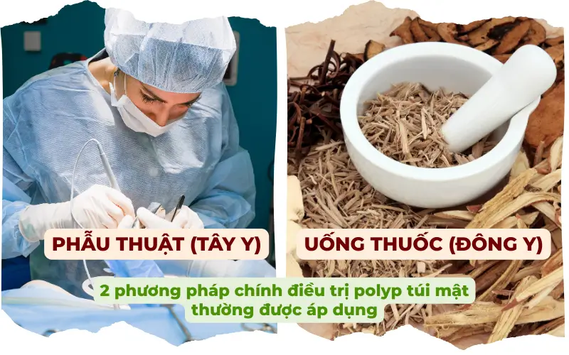 Tây y (phẫu thuật) và Đông y (uống thuốc) là 2 phương pháp điều trị polyp túi mật phổ biến hiện nay.