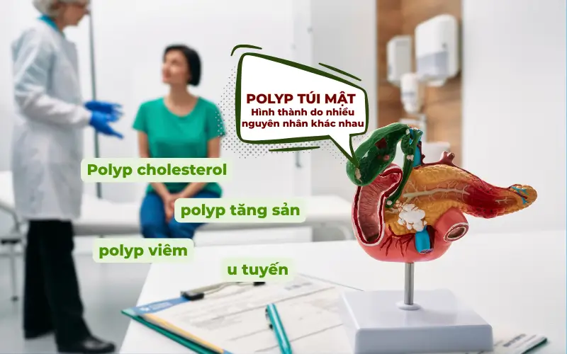 Polyp túi mật hình thành do nhiều nguyên nhân khác nhau