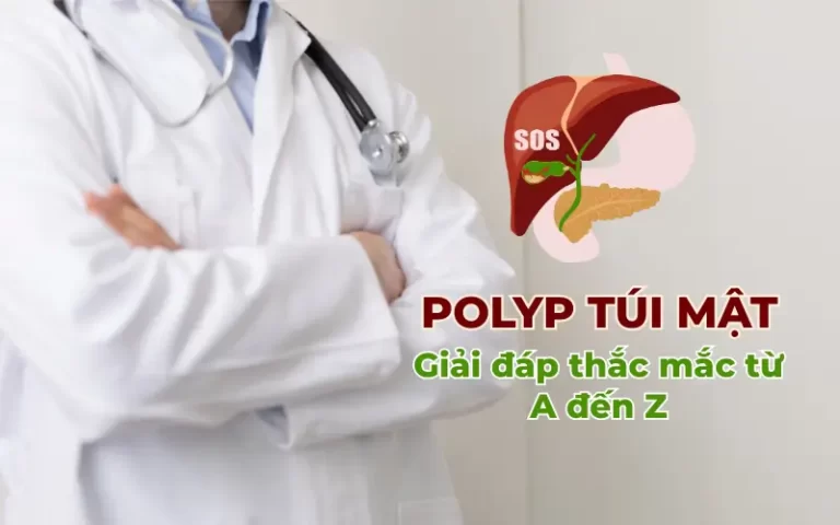 Polyp túi mật