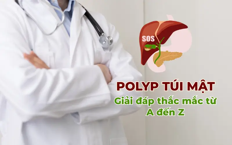 Polyp túi mật