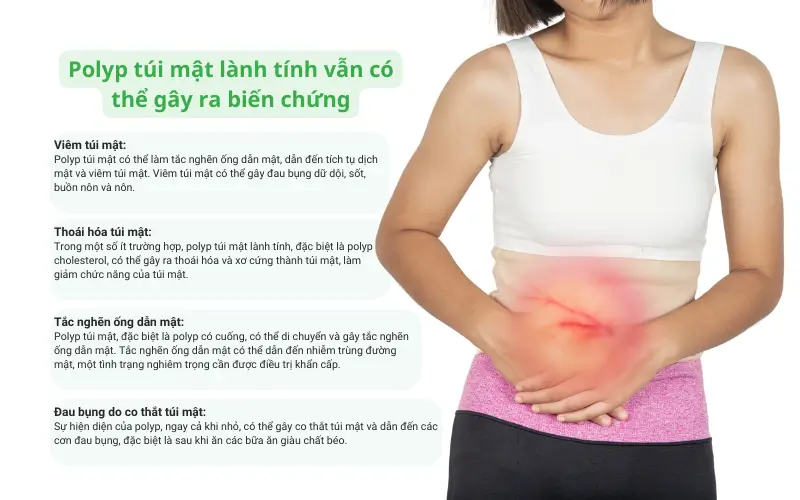 Hóa Ứ Tiêu Tích Lợi Đởm Thang: Bài thuốc Nam điều trị polyp túi mật hiệu quả | Đông y Sơn Hà Polyp túi mật lành tính vẫn có thể gây ra một số biến chứng nếu không điều trị kịp thời