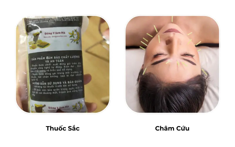 Liệu trình điều trị mắt tại Đông y Sơn Hà