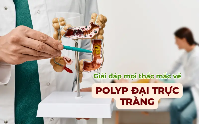 Polyp đại tràng