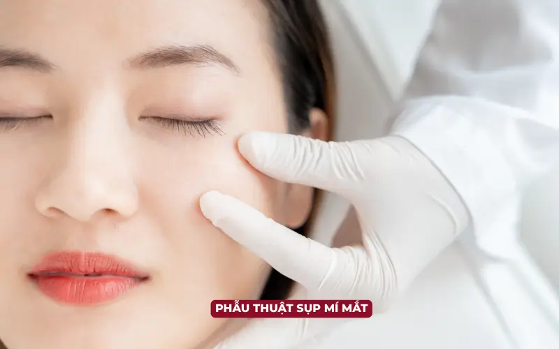 Sụp Mí Mắt (Ptosis): Phân Tích Chuyên Sâu Về Phân Loại, Cơ Chế Bệnh Sinh, Chẩn Đoán và Hướng Điều Trị (cập nhật 2025) Phẫu thuật là phương pháp điều trị phổ biến nhất cho sụp mí mắt