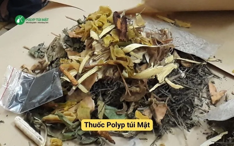 Hóa Ứ Tiêu Tích Lợi Đởm Thang: Bài thuốc Nam điều trị polyp túi mật hiệu quả | Đông y Sơn Hà thuoc-nam-dieu-tri-polyp-tui-mat.webp