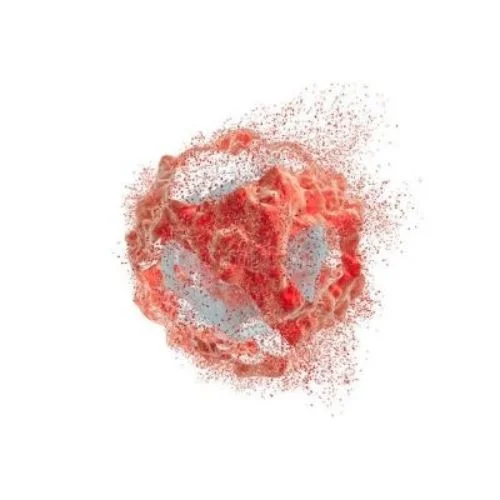 Hóa Ứ Tiêu Tích Lợi Đởm Thang: Bài thuốc Nam điều trị polyp túi mật hiệu quả | Đông y Sơn Hà tieu polyp khoi u