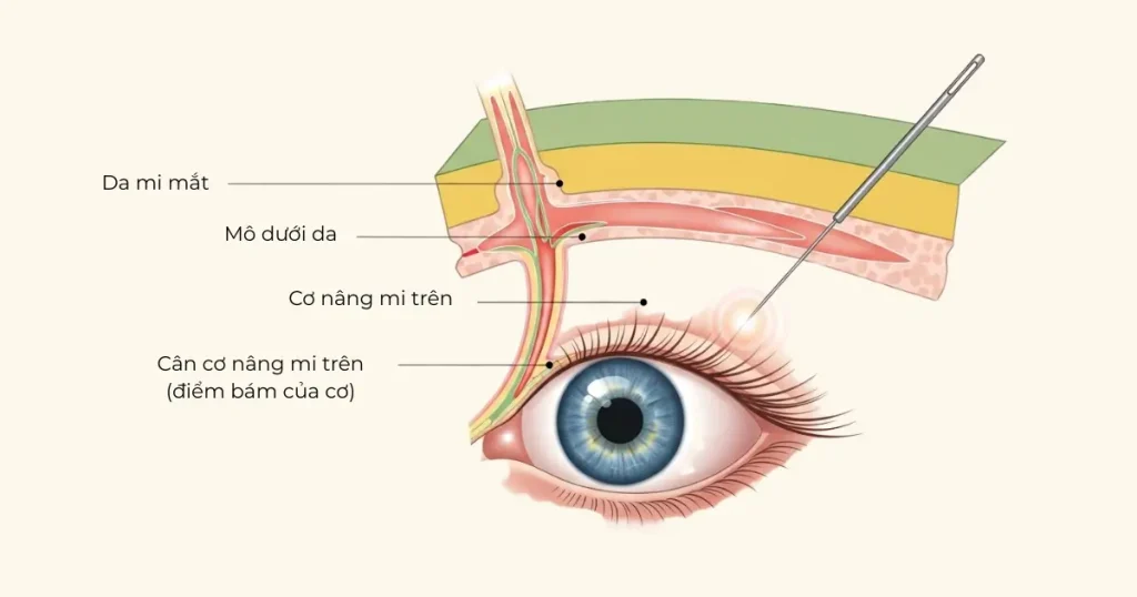 cham cuu chua sup mi mat 02