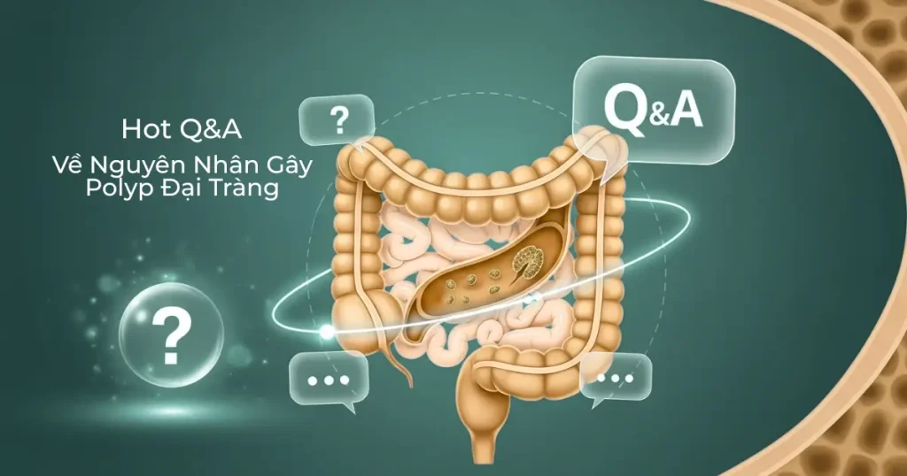 Giải Đáp Nhanh 10+ Thắc Mắc "Nóng" Về Nguyên Nhân Gây Polyp Đại Tràng