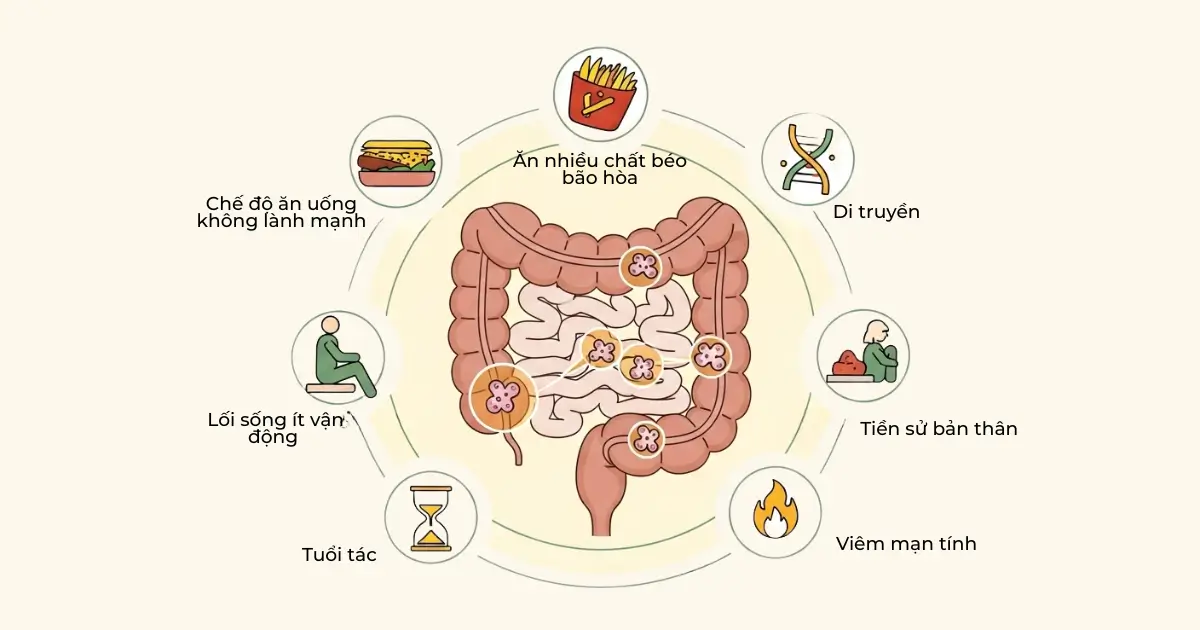 Nguyên Nhân Gây Polyp Đại Tràng