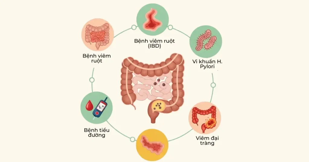 nguyen nhan polyp dai trang 02png